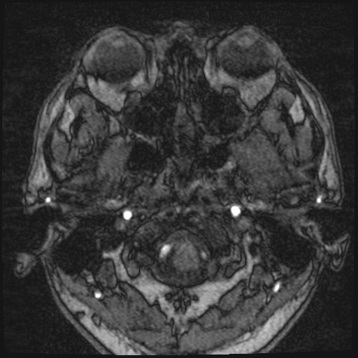 Click on the Serie image to view the images of VILLANUEVA, WILLIAM A.